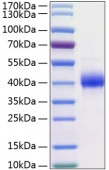 Active Recombinant Human Kallikrein-11/KLK11 Protein (RP00149)