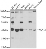 ACAT2 Rabbit pAb (A7866)