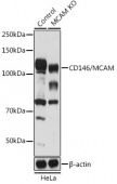 [KO Validated] CD146/MCAM Rabbit pAb (A19993)