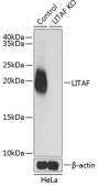 [KO Validated] LITAF Rabbit pAb (A5469)