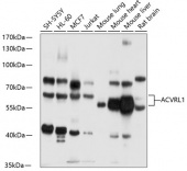 ACVRL1 Rabbit pAb (A1791)