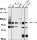 ADAM28 Rabbit pAb (A9512)