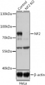 [KO Validated] NF2 Rabbit pAb (A0739)
