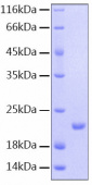 Recombinant Human IL-25/IL-17E  Protein (RP00406)