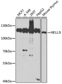 [KO Validated] Lsh/HELLS Rabbit pAb (A5831)