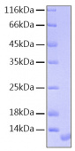 Recombinant Human Pro-neuregulin-1/NRG1 Protein (RP00055)