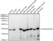 ACADS / SCAD Rabbit mAb (A20926)