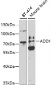 ADD1 Rabbit pAb (A1592)