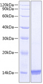 Recombinant Human PDGFB Protein (RP00834)