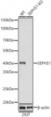 [KO Validated] SEPHS1 Rabbit pAb (A13403)