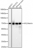[KO Validated] NF2/Merlin Rabbit mAb (A23186)