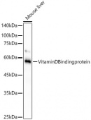 Vitamin D Binding protein Rabbit mAb (A21977)