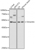 [KO Validated] Vimentin Rabbit pAb (A11952)
