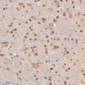 Anti -ABCA7 Rabbit pAb