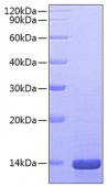 Recombinant Mouse Beta-NGF Protein (RP00667)