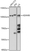 ADAM8 Rabbit pAb (A10497)
