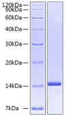 Recombinant Human Neurotrophin-3/NGF-2/NT-3 Protein (RP00496)