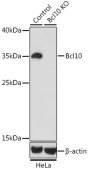[KO Validated] Bcl10 Rabbit pAb (A1106)