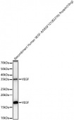 VEGF Rabbit mAb (A23759)
