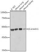 β-arrestin1 Rabbit mAb (A10742)