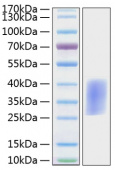 Recombinant Mouse PD-1/PDCD1/CD279 Protein (RP01170)