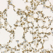 WEE1 Rabbit mAb (A22275)