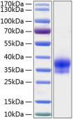 Active Recombinant Human IGFBP-6 Protein (RP00145)