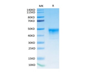 Biotinylated Recombinant Human Mesothelin/MSLN Protein (RP02448)