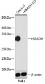 [KO Validated] HIBADH Rabbit pAb (A19871)