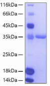 Active Recombinant Human TIE2/TEK/CD202b Protein (RP00048)