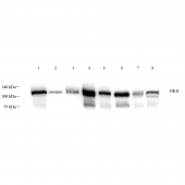 GB121063 Anti -Hexokinase II Mouse Monoclonal