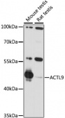 ACTL9 Rabbit pAb (A15974)