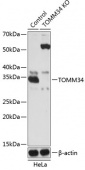 [KO Validated] TOMM34 Rabbit pAb (A19960)