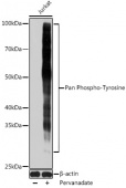 Pan Phospho-Tyrosine Mouse mAb (AP0973)