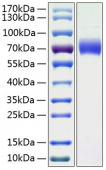 Active Recombinant Human Kininogen-1/KNG1 Protein (RP01026)