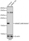 [KO Validated] ARMET/ARP/MANF Rabbit pAb (A13371)