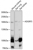 ADGRF5 Rabbit pAb (A5205)