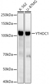 YTHDC1 Rabbit mAb (A22992)