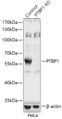 [KO Validated] PTBP1 Rabbit pAb (A18052)