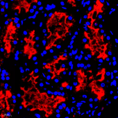 Anti -CTGF Rabbit pAb