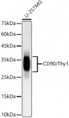 [KO/KD Validated] CD90/Thy1 Rabbit mAb (A23224)