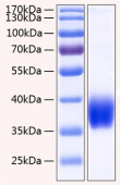 Active Recombinant Human Carbonic anhydrase 12 Protein (RP00157)
