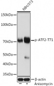 Phospho-ATF2-T71 Rabbit mAb (AP1051)