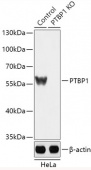 [KO Validated] PTBP1 Rabbit pAb (A18084)