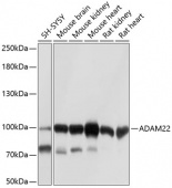 ADAM22 Rabbit pAb (A10030)