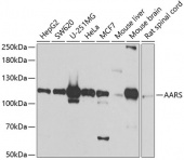 AARS Rabbit pAb (A7864)