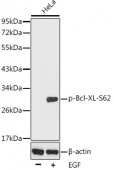 Phospho-Bcl-XL-S62 Rabbit pAb (AP0314)