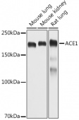 ACE1 Rabbit pAb (A2805)