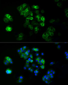 ABflo® 488 Rabbit anti-Human TROP-2 mAb (A22577)