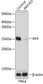[KO Validated] AK4 Rabbit pAb (A19855)